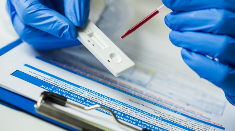 Megnyugtató hír érkezett: a meglévő tesztek kimutatják a mutáns koronavírust is