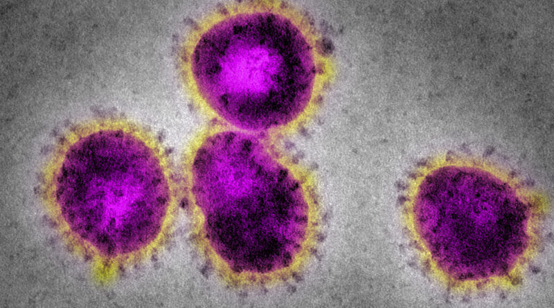 Koronavírus: újabb angliai térségek kerültek a legnagyobb szigor alá