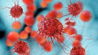 Felfedezték a rák egy új, magas kockázatú altípusát