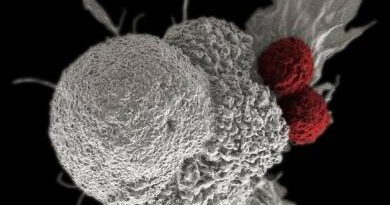 Szegedi kutatók arany nanoszerkezetei segíthetik a daganatok korai felismerését
