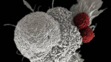 Szegedi kutatók arany nanoszerkezetei segíthetik a daganatok korai felismerését